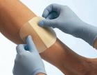 В России запущено производство пенополиуретанового покрытия для лечения повреждений кожи