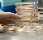 В Югре проводятся операции по трансплантации стволовых клеток