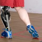 Показания к протезированию коленного сустава