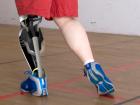 Показания к протезированию коленного сустава