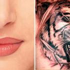 Лазерное удаление татуажа