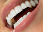 Что представляют собой покрывные протезы для зубов?