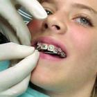 Аномалии зубов и способы исправления