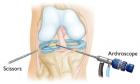 Артроскопия – непростая методика исследования суставов