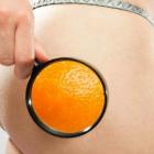 Целлюлит: вся проблема в стрессе