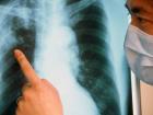 Чем опасен туберкулез?