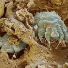 Чесотка и основные ее особенности