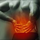 Что делать при радикулите?