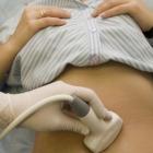 Дисфункция яичников