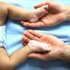 Дисплазия тазобедренного сустава у новорожденного