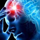 Факторы риска, приводящие к инсульту