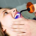 Фотополимерные пломбы