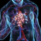 Ишемическая болезнь сердца: возникновение и профилактика