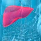 Как избавится от жирового гепатоза печени?