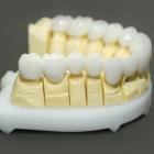 Как производится зубное протезирование?