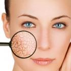 Как ухаживать за сухой кожей?