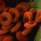 Каковы последствия недостатка гемоглобина в крови и как его быстро повысить?