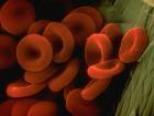 Каковы последствия недостатка гемоглобина в крови и как его быстро повысить?