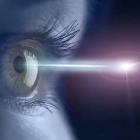 Лазерная микрохирургия глаза - лечение близорукости
