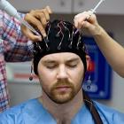 Лечение эпилепсии