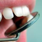 Лечение зубов