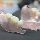 Нейлоновые протезы зубные