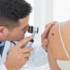 О раке кожи