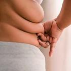 Здоровье женщины и ожирение в репродуктивном и менопаузальном периодах