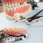 Оптимальный вариант протезирования зубов