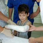 Переломы костей у детей: стадии заживления