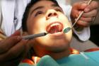 Пломбирование зубов в стоматологии