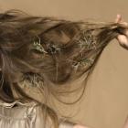 Почему выпадают волосы?