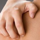 Почему зудит тело?