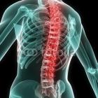 В чем твоя основа: береги позвоночник смолоду