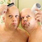 Причины плешивости