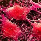 Причины рака