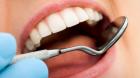 Причины удаления зубов