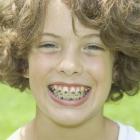 Проблемы зубов у детей