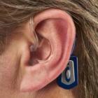 Разновидности слуховых аппаратов
