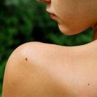 Рак трудно вылечить, но им можно не болеть