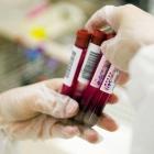 Самодиагностика организма