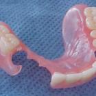 Съемное зубное протезирование