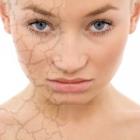 Сухость кожи: причины и методы преодоления