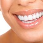 Убрать дефекты зубов поможет наращивание