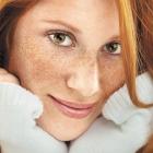 Виды пигментных пятен