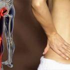 Воспаление седалищного нерва