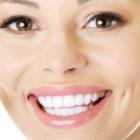 Вся правда об отбеливании зубов