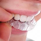 Выравнивание зубного ряда