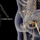 Заболевание пояснично-крестцового отдела: ишиас