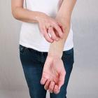 Заболевания кожи связанные с аллергией